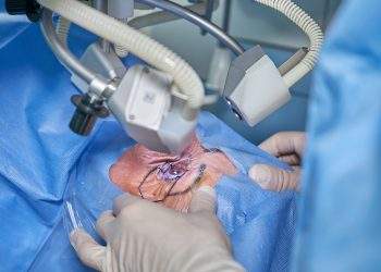 eye laser surgery, eye operation, doctor