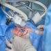 eye laser surgery, eye operation, doctor