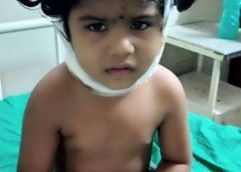 गोठणगाव येथील पाच वर्षीय मुलीवर बिबट्याचा हल्ला