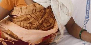 तीन अस्वलांच्या जीवघेण्या हल्ल्यात महिला गंभीर जखमी.